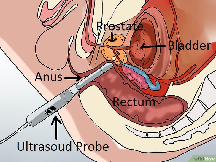 Recognize-Prostate
